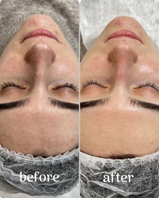 BEAUTY SECRET KOSMETOLOG & STYLISTKA BRWI i RZĘS