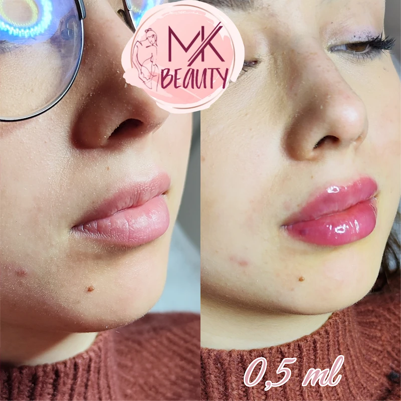 MK Beauty Kosmetologia twarzy i ciała